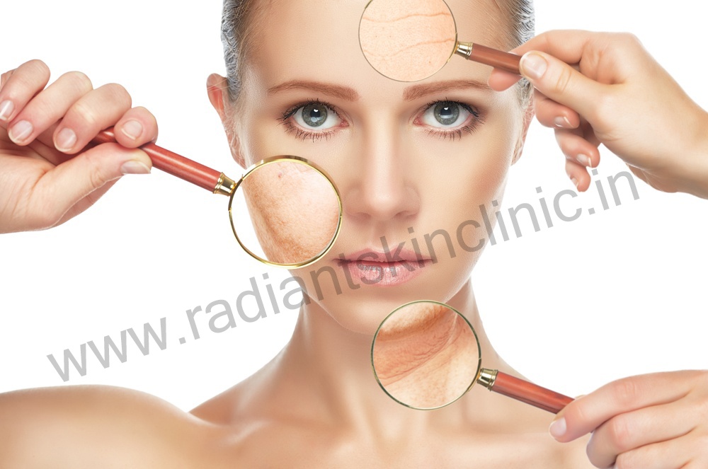 facial rejuvenation procedures houston texas acne treatment in jaipur acne doctor jaipur scar treatment in jaipur best scar treatment in jaipur
