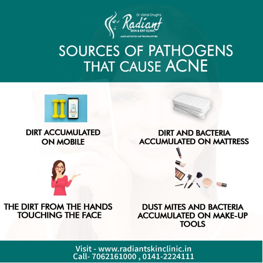 sources of pathogen