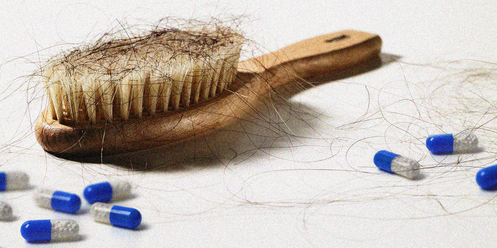 5-15-hairloss-index-1558456888 best hair transplant treatment in jaipur