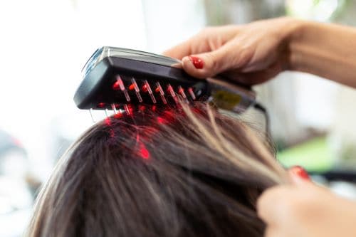 Laser-Comb best hair transplant treatment in jaipur