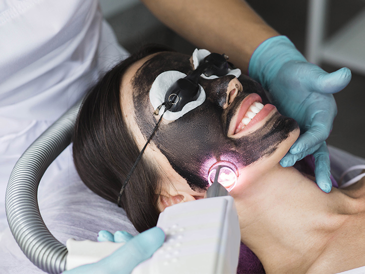 Laser Skin peel treatment in Jaipur