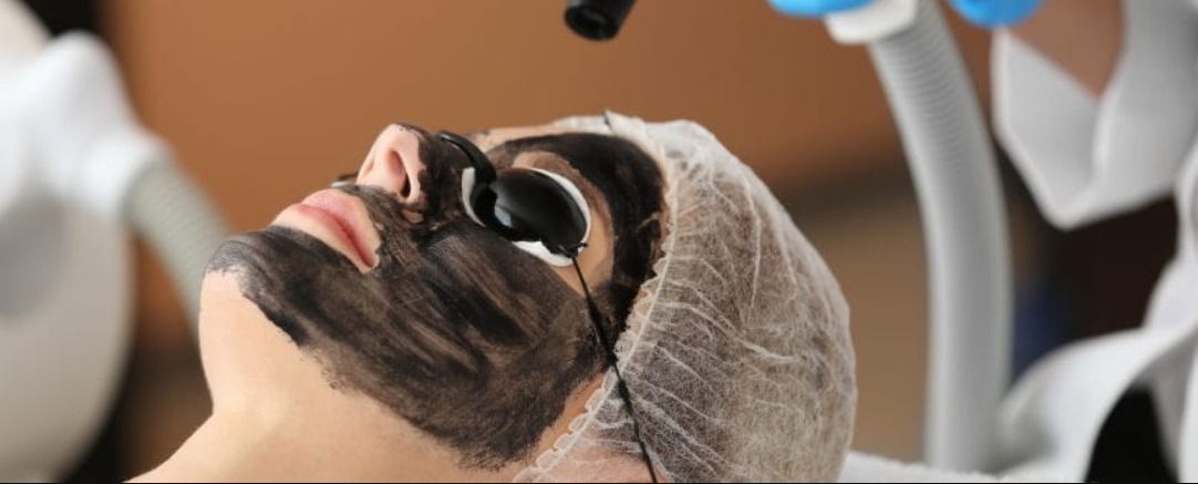 hollywood skin peel treatment in Jaipur hollywood peeling treatment