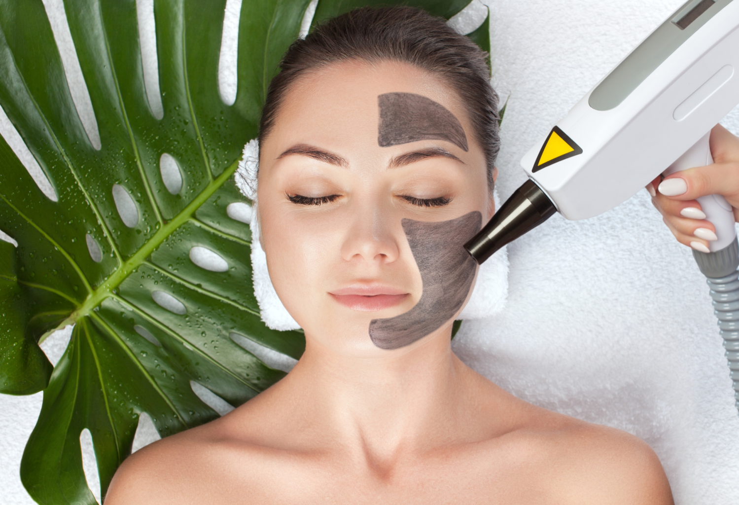 carbon peeling treatment in jaipur carbon peeling treatment in jaipur