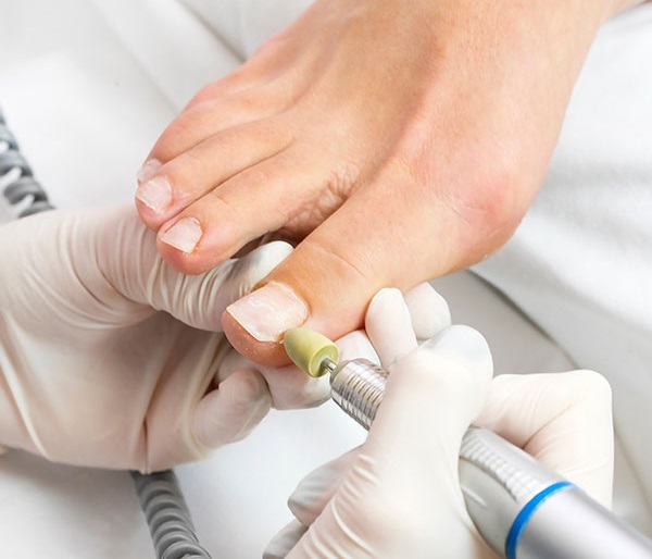 best nail surgery treatment in jaipur with Radiant Clinic Best Nail Treatment Surgery in Jaipur