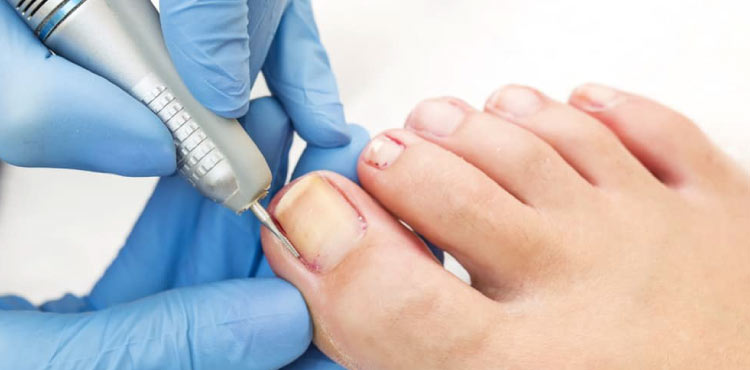 ungiectomy procedure