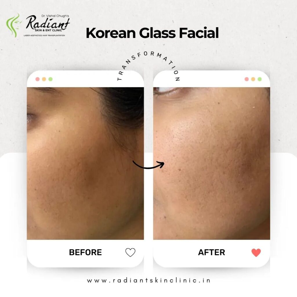 Best Korean Glass Facial in Jaipur