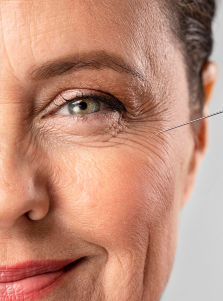 botox treatment in jaipur, dermal fillers treatment in jaipur