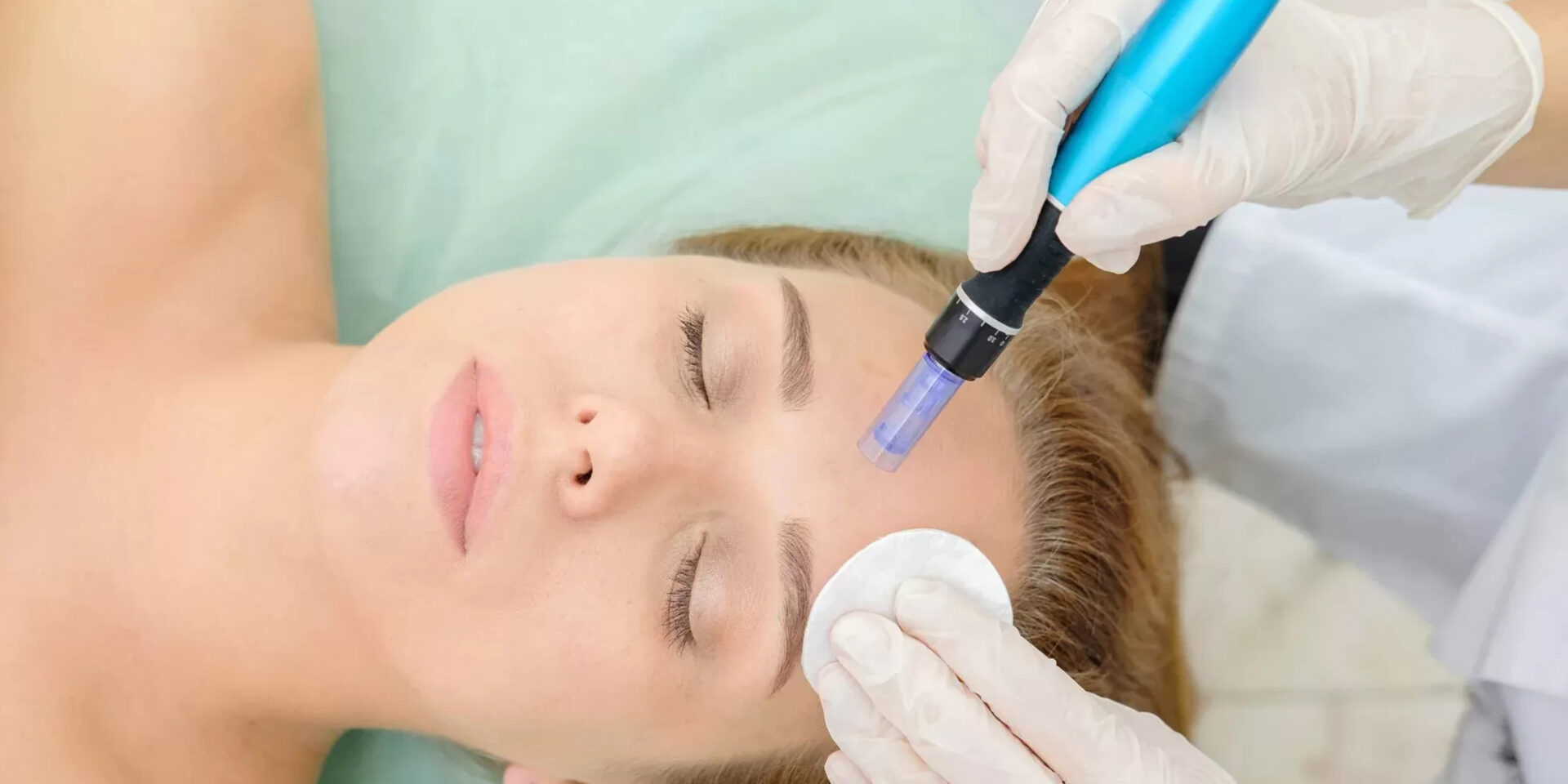 Best Microneedling Treatment in Jaipur