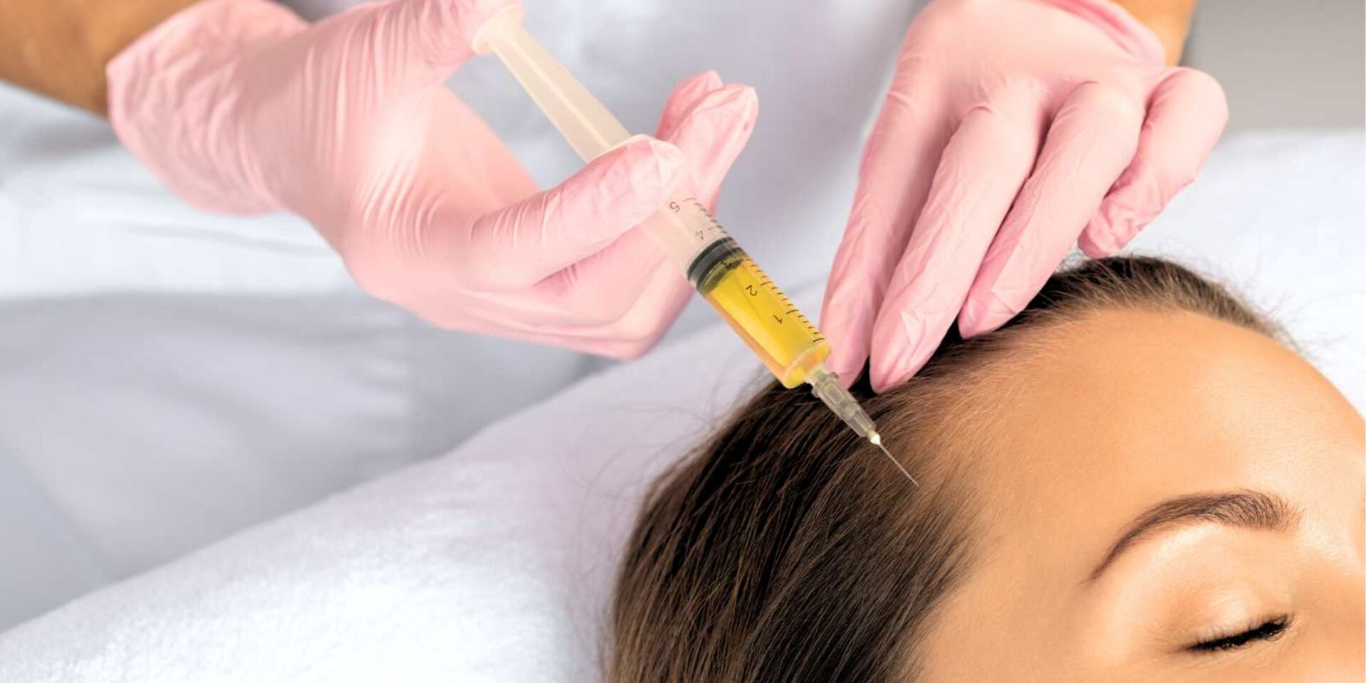 Best PRP Hair Treatment in Jaipur