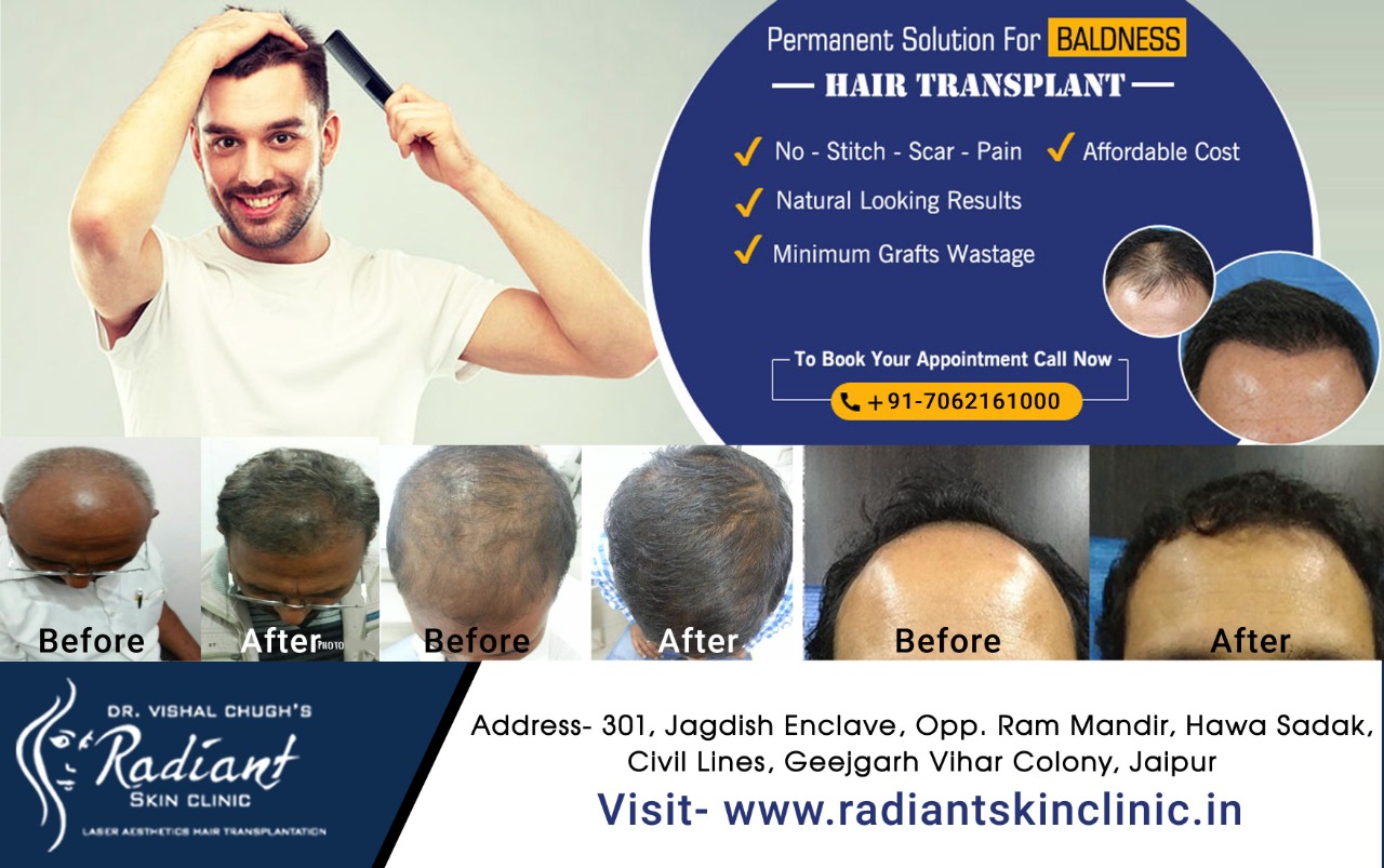 Best Doctors For Hair Loss Treatment In Jaipur