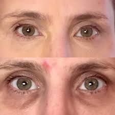 Best Skin Specialist Doctor in Jaipur