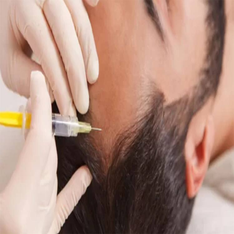 PRP Treatment Cost in Jaipur