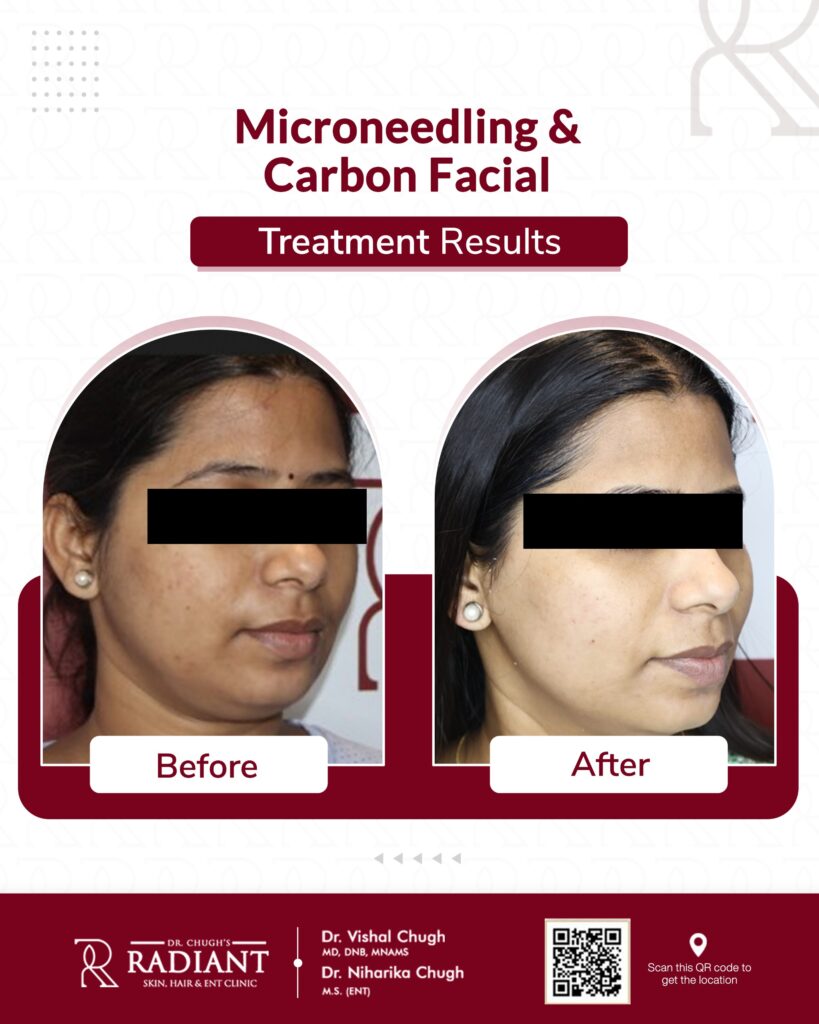 Best Medifacials Treatment in Jaipur