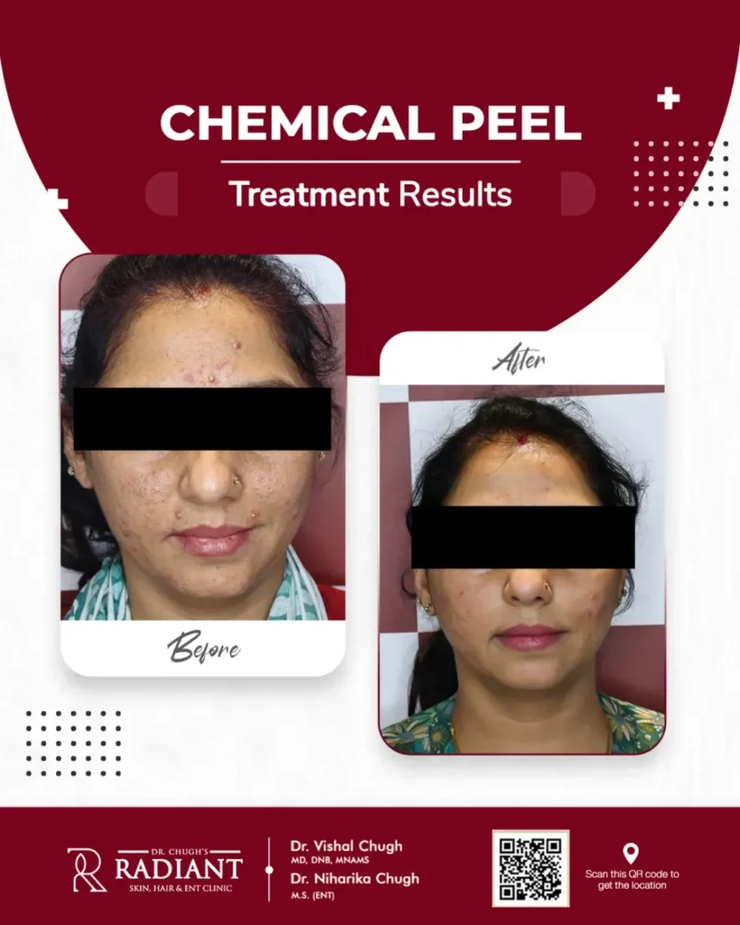 Best Dermatologist in Jaipur